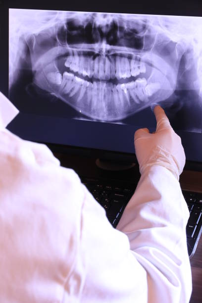Best Emergency Treatment for Oral Infections in Otsego, MI